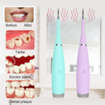 Electric Sonic Dental Tooth Calculus Remover Tooth Stains Cleaner - Image 3