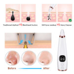 Facial microcry stalline blackhead skin beauty instrument - Image 4