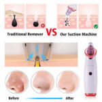 Electric Acne Remover Blackhead Remover Apparatus - Image 4